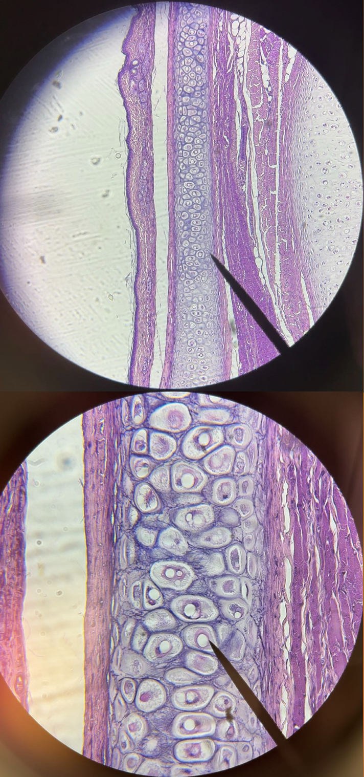 <p>tissue</p>