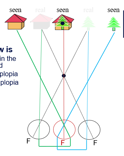 <p>Fly, tree and house appeared in the same visual direction. </p><p>Because the tree and house were beyond the fixation point, they produced uncrossed diplopia, so it appeared that each of the two images shared the same visual direction</p>