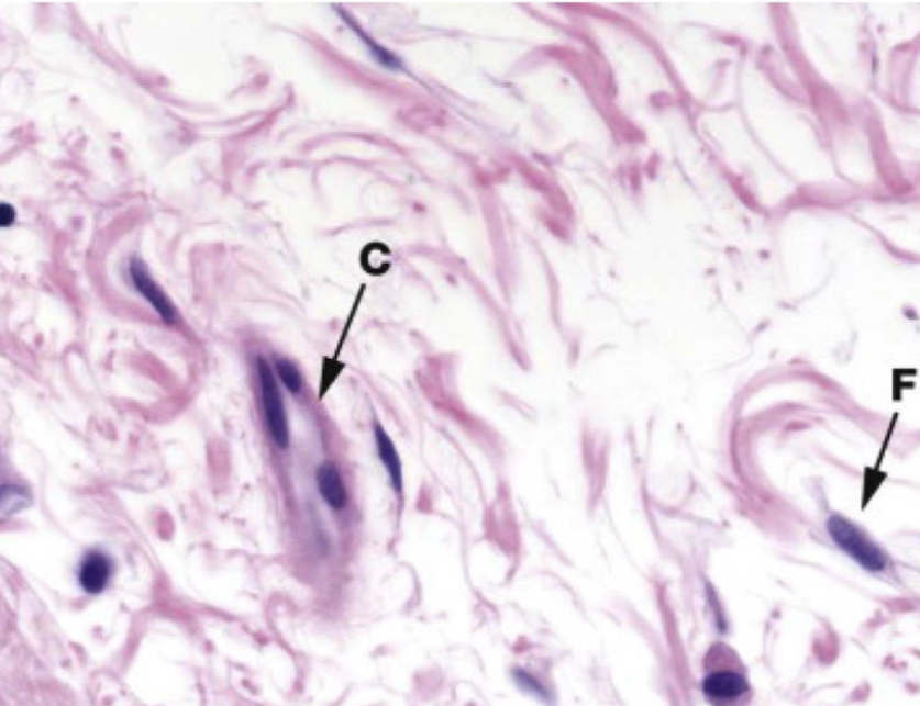 <p>identify the type of connective tissue</p>