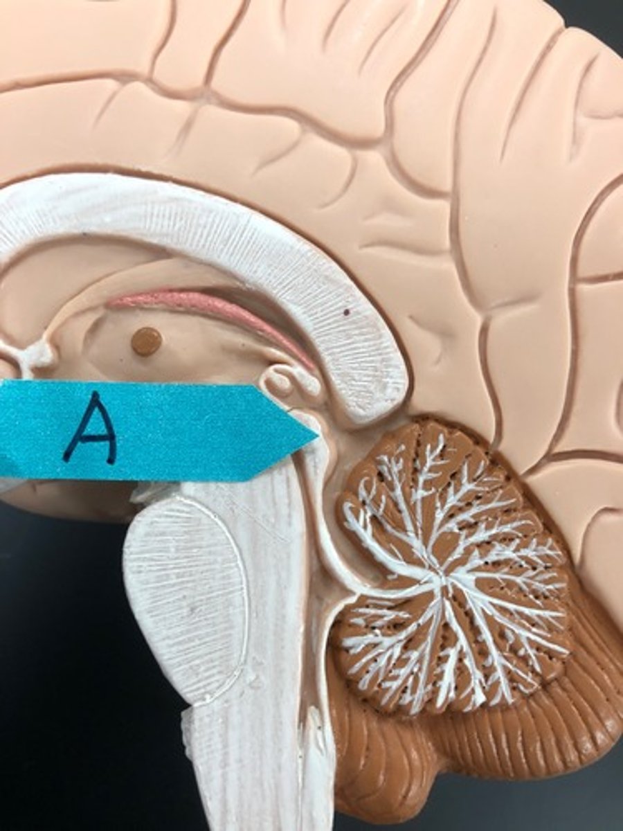 <p>Identify this general area (with the two "bumps" together).</p>