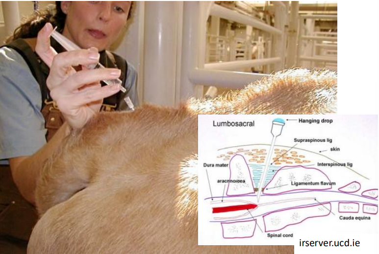 <ul><li><p>lift tail up/down - ID junction between <strong>last stationary</strong> and <strong>first moving</strong> vertebrae (sacrococcygeal space S5-C1)</p><ul><li><p>or (C1-C2)</p></li></ul></li><li><p>clip and surgical scrub site</p></li><li><p><strong>18 g x 1.5 inch</strong> needle (adult cow)</p></li><li><p>hanging drop or attached syringe (inject w/ no resistance)</p></li><li><p>insert needle <strong>90 degrees</strong> to skin</p></li><li><p>1ml/100kg dose</p></li><li><p>local anesthetic and Xylazine (extends duration of epidural)</p></li></ul><p></p>