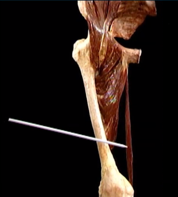 <p>Diep, anterior zicht</p>