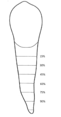 <p>2 mm from CEJ is normal</p>