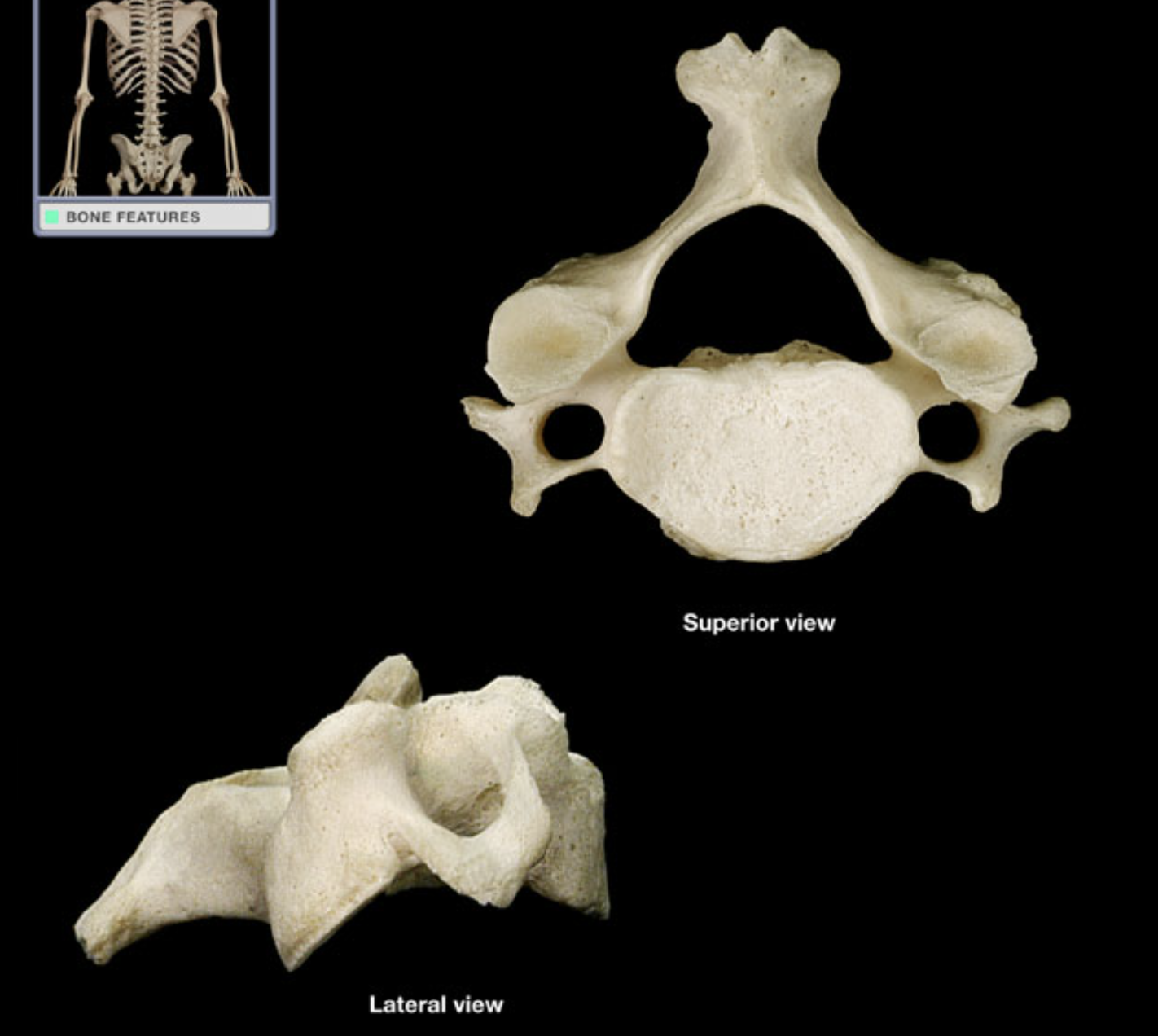 <p>What kind of vertebrae?</p>