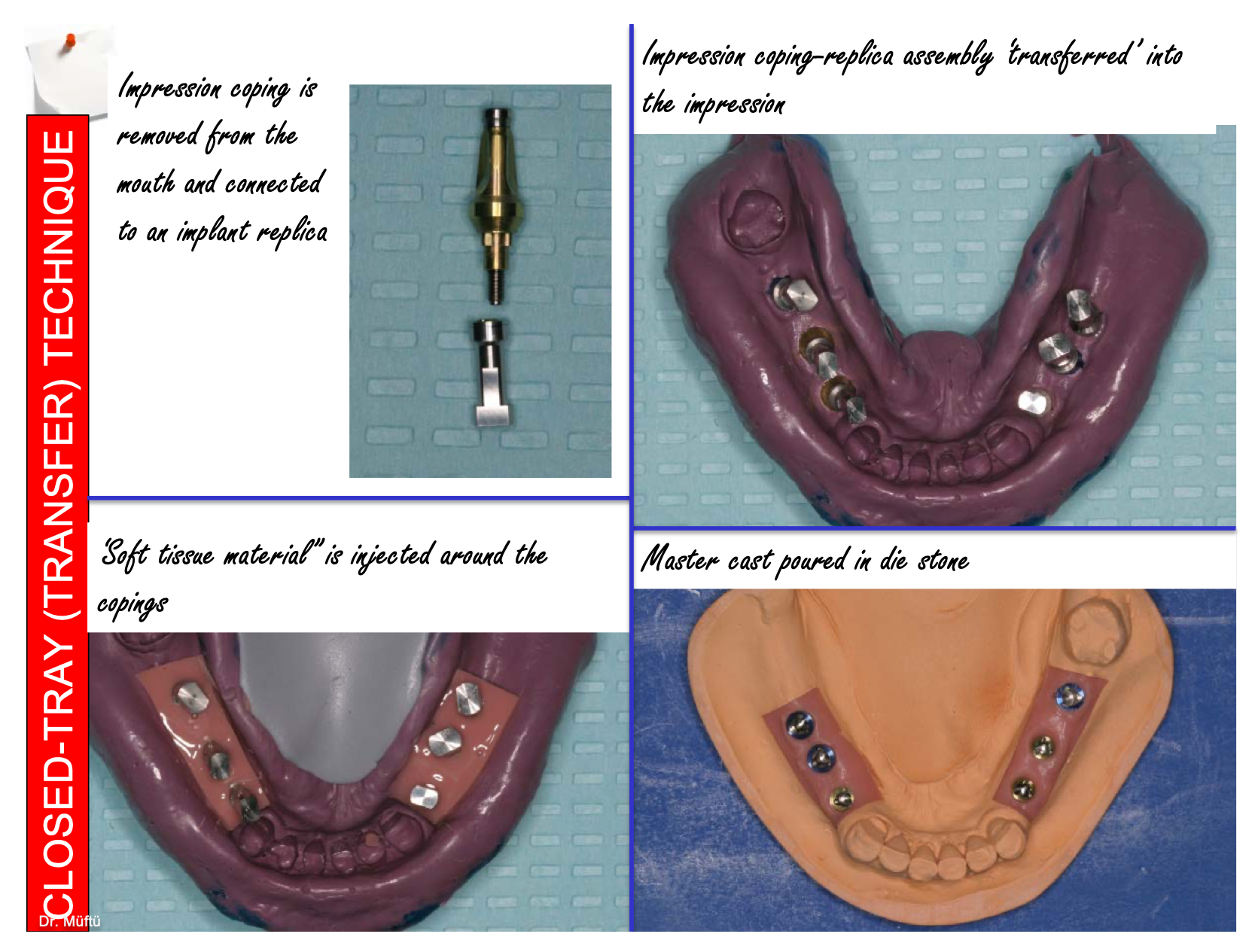 <p>closed tray / transfer technique</p>