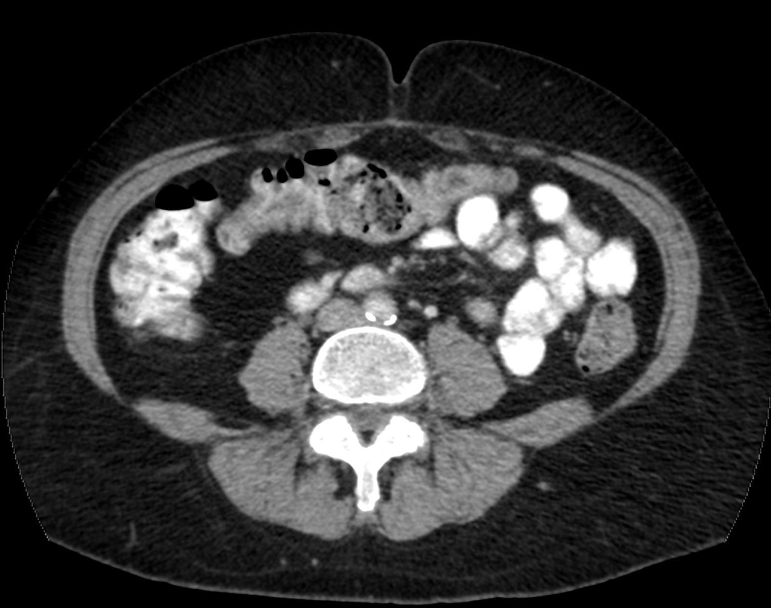 <p>how are these images produced in CT? </p>