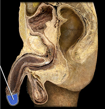 <p>what structure is highlighted?</p>