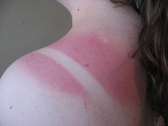 <p>adj. Very painful.</p>