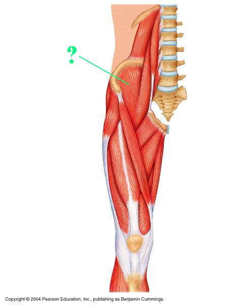 <p>Identify the indicated muscle</p>