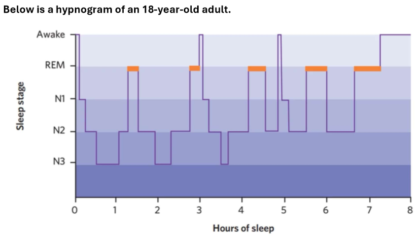 <p>Describe this hypnogram of an 18-year-old adult (total hours of sleep/ no. of cycles, expected or not, no. of brief wake ups, trend of REM sleep/NREM sleep throughout the night, approx. duration of one sleep cycle).</p>
