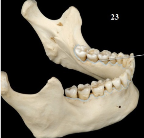 <p>Name This Structure where the teeth sit</p>
