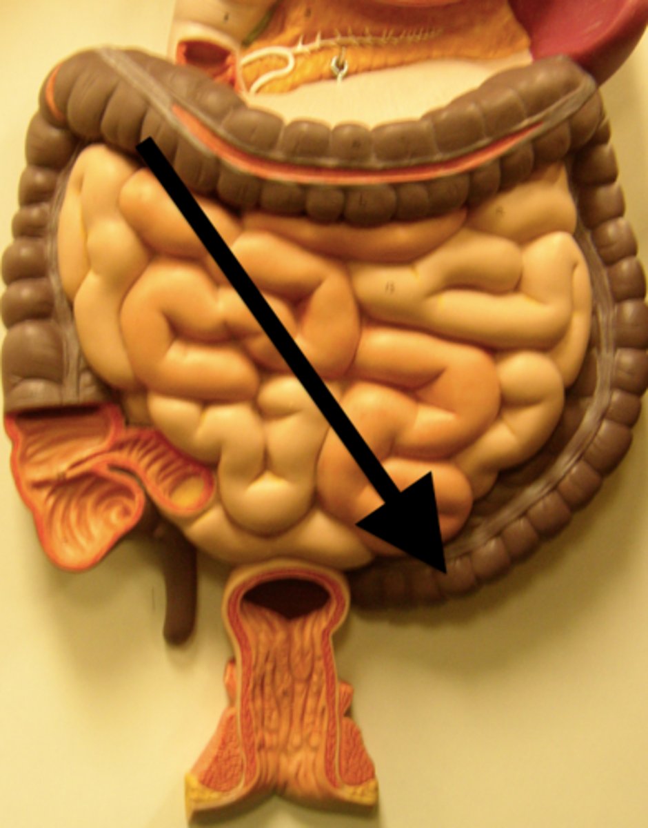 <p>sigmoid colon</p>