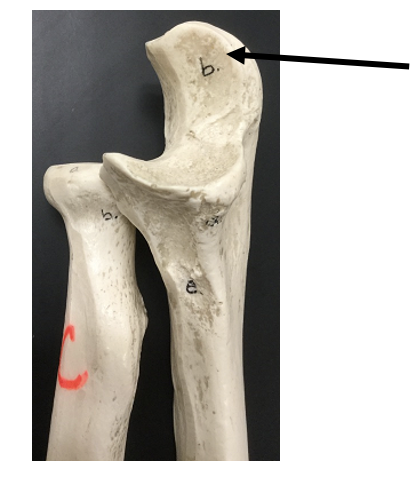 <p>What bone and bone feature is this?</p>