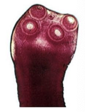 <ul><li><p>Taenia saginata </p></li><li><p>causes Taeniasis<span> (Intestinal beef tapeworm infection)</span></p></li></ul><p></p>
