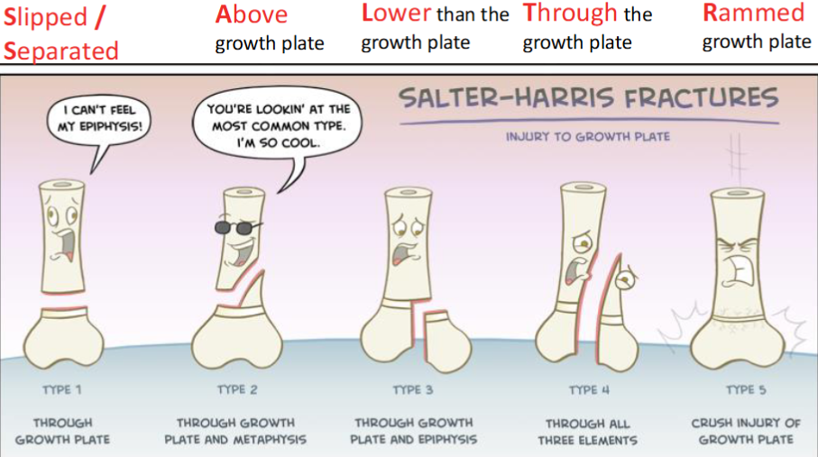 <ol><li><p>type I (slipped/separated)</p><ul><li><p>separation of epiphysis from metaphysis</p></li></ul></li><li><p>type II (above the growth plate)</p><ul><li><p>through growth plate + metaphysis</p></li></ul></li><li><p>type III (lower than the growth plate)</p><ul><li><p>through growth plate + epiphysis</p></li></ul></li><li><p>type IV (through the growth plate)</p><ul><li><p>through all 3 elements</p></li></ul></li><li><p>type V (rammed growth plate)</p><ul><li><p>crush injury of growth plate</p></li></ul></li></ol><p></p>