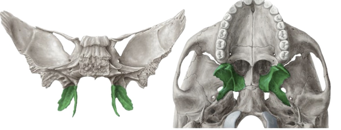 <p>What bone is this?</p>