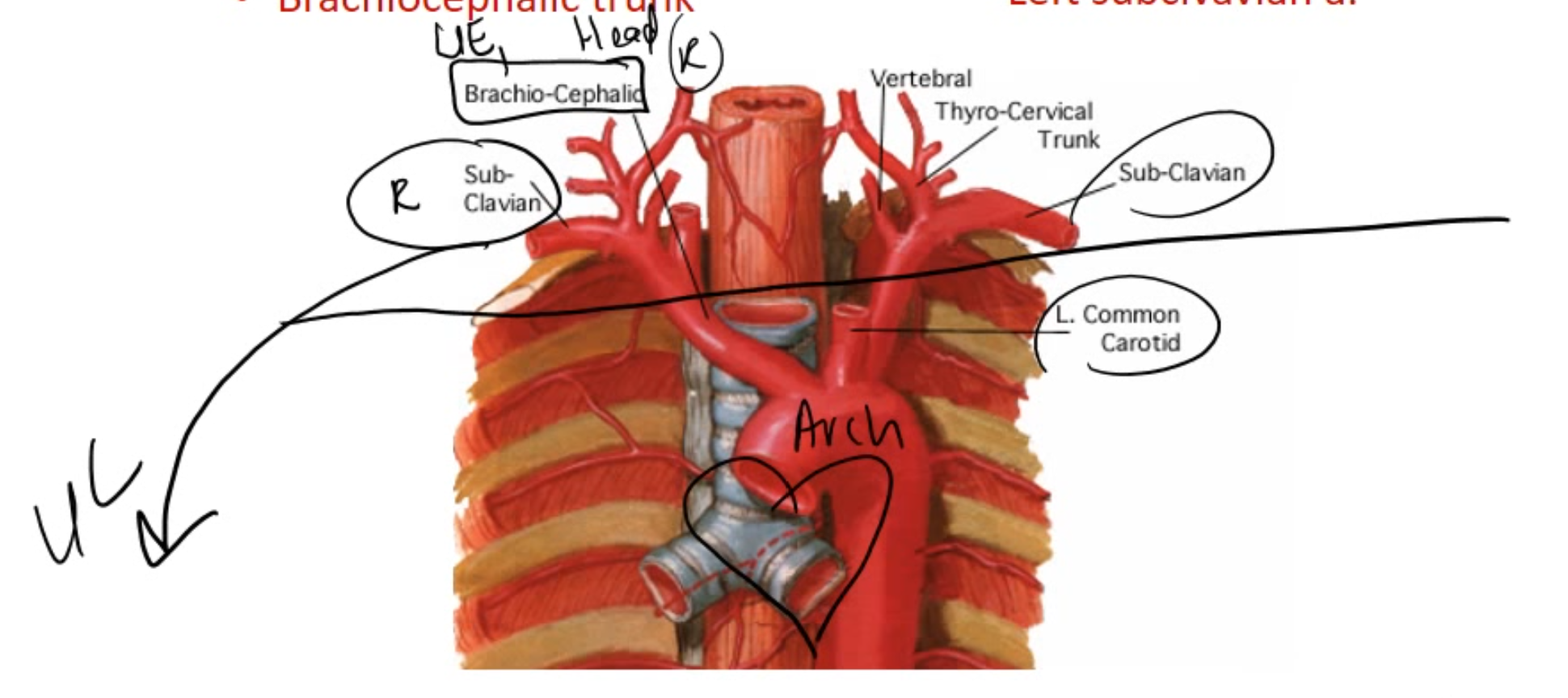 <p>Right side gives off one artery:</p><ul><li><p><span style="color: yellow;"><strong>1) Brachiocephalic trunk</strong></span></p></li></ul><p>.</p><p>Left side gives off 2 arteries:</p><ul><li><p><span style="color: rgb(62, 229, 46);">Left common carotid a.</span></p></li><li><p><span style="color: rgb(54, 244, 57);">Left subclavian a.</span></p></li></ul><p></p>