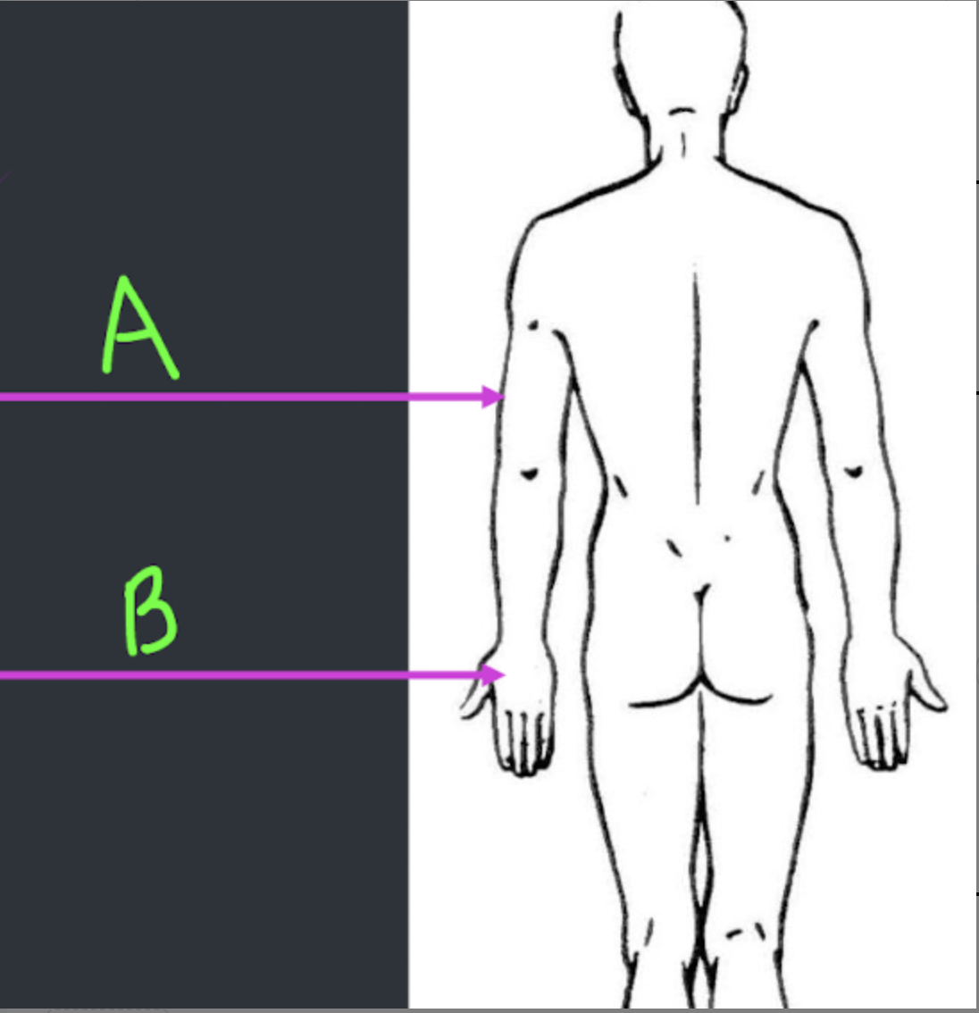<p>What anatomical direction describes B?</p>