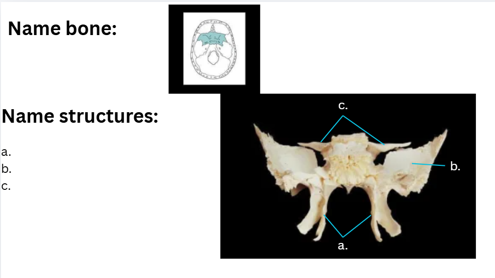 <p>B?</p>
