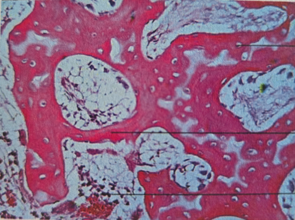 <p>cancellous bone</p>