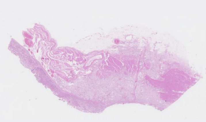 <p>stomach from a 71 year old male</p>
