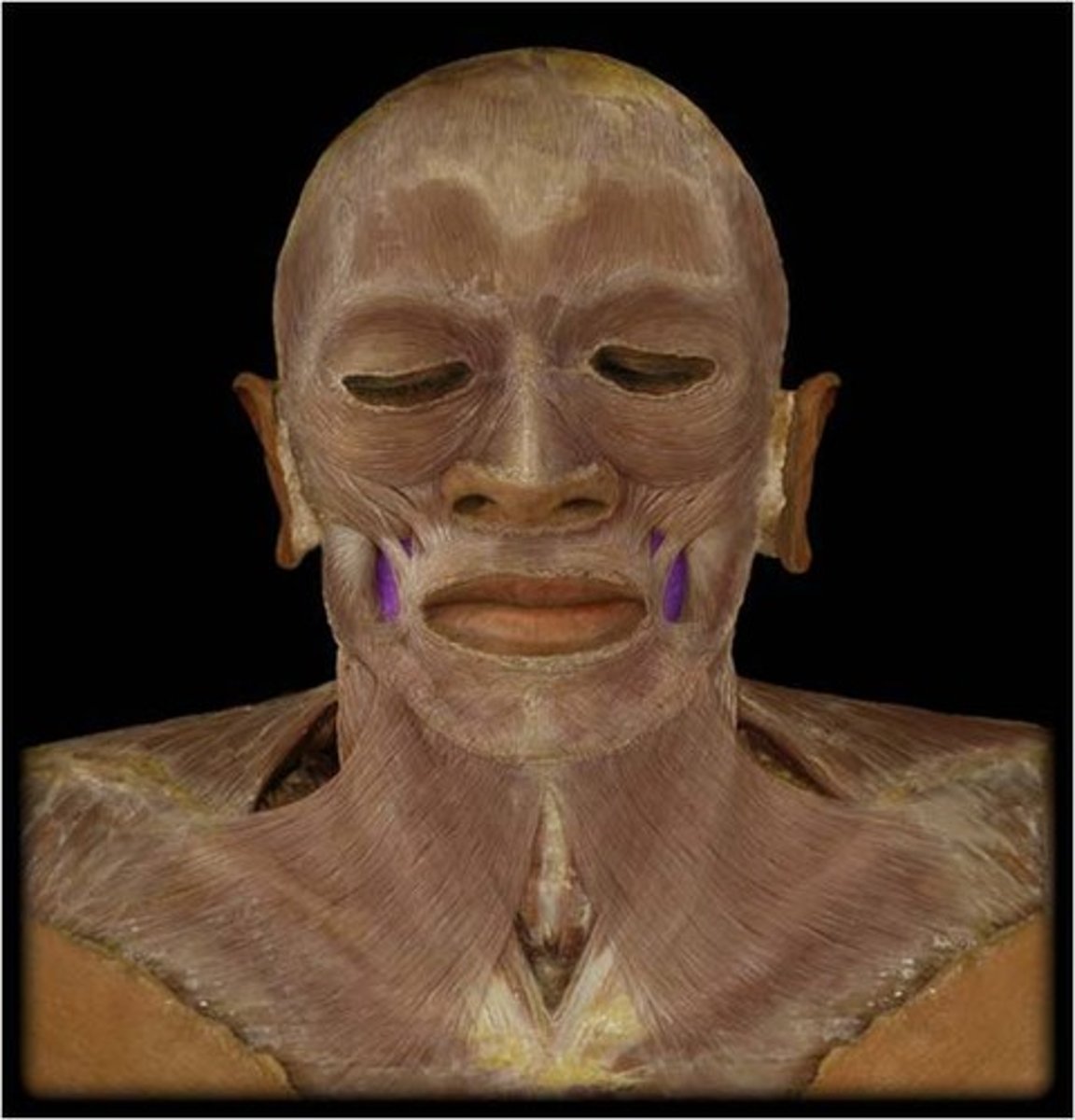 <p>Region:</p><p>Face</p><p>Action: </p><p>Compresses cheek </p><p>Innervation: </p><p>CN VII</p>