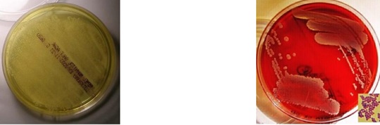 <p>This microorganism appears as <strong>yellow</strong> on <strong>MSA plates</strong> due to <strong>fermentation of mannitol </strong>and causes <strong>beta hemolysis</strong> on <strong>blood agar plates</strong>, which microorganism is it?</p>