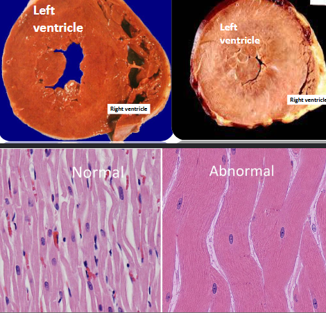 <p>What non-neoplastic distrubance of growth</p>
