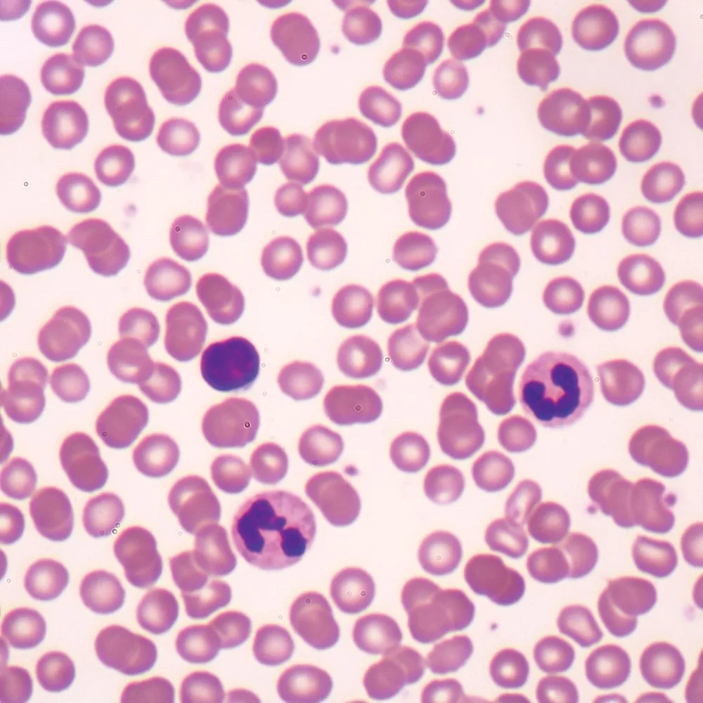 <p>-Function: Transports oxygen, nutrients, hormones, and wastes; helps regulate temperature and fight infection</p><p>-Found: Blood vessels and heart</p><p>-Description: Fluid connective tissue made of plasma, red blood cells, white blood cells, and platelets.</p>