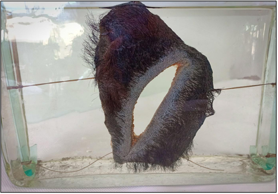 <p>Questions</p><ol><li><p>What is the specimen being examined?</p></li><li><p>What are the descriptive features of the injury on the scalp?</p></li><li><p>What is the likely causative instrument for this type of injury?</p></li><li><p>How is the time of death estimated in relation to the injury?</p></li><li><p>What are the possible causes of death?</p></li><li><p>What is the final diagnosis for this specimen?</p></li></ol><div data-type="horizontalRule"><hr></div><p></p>