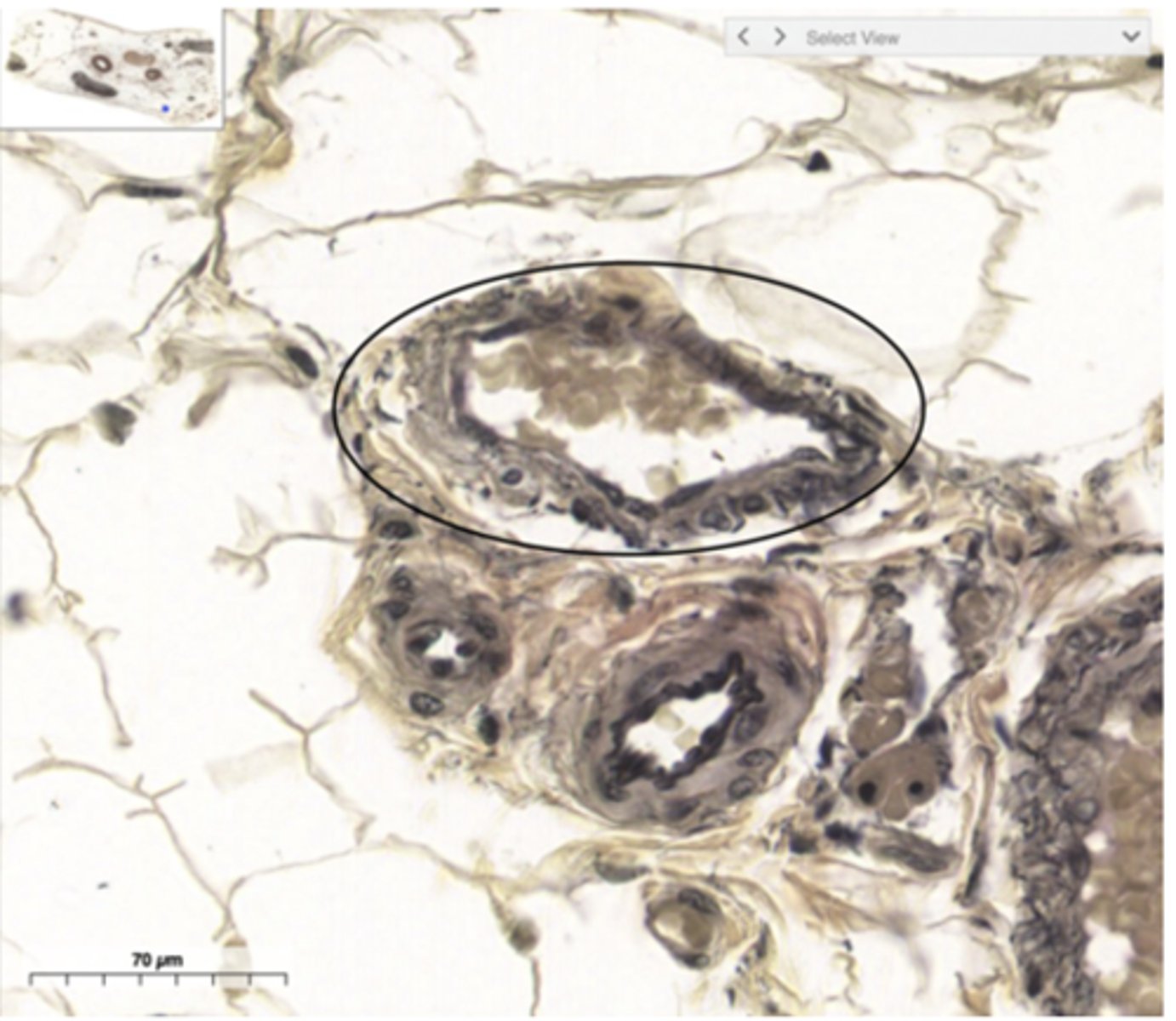 <p>Classify the vessel</p>