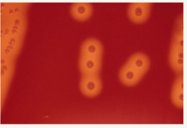 <ul><li><p><strong><u>GROUP A -</u><em><u> S. pyogenes </u></em></strong></p><ul><li><p>Throat, skin/soft tissue, invasive disease, post strep sequelae </p></li><li><p>TAXO-A/ PYR/ antigen testing</p></li></ul></li><li><p><strong><u>GROUP B - </u><em><u>S. agalactiae </u></em></strong></p><ul><li><p>pregnancy/newborn disease; screen vaginal + rectal swabs</p></li><li><p>CAMP/ hippurate/ NAAT </p></li></ul></li><li><p><strong>GROUPS C/G</strong></p><ul><li><p>may cause pharyngitis, impetigo, pyogenic infections; Lancefield typing helps </p></li><li><p>normally tested w KITS instead of growth </p></li></ul></li></ul><p></p>