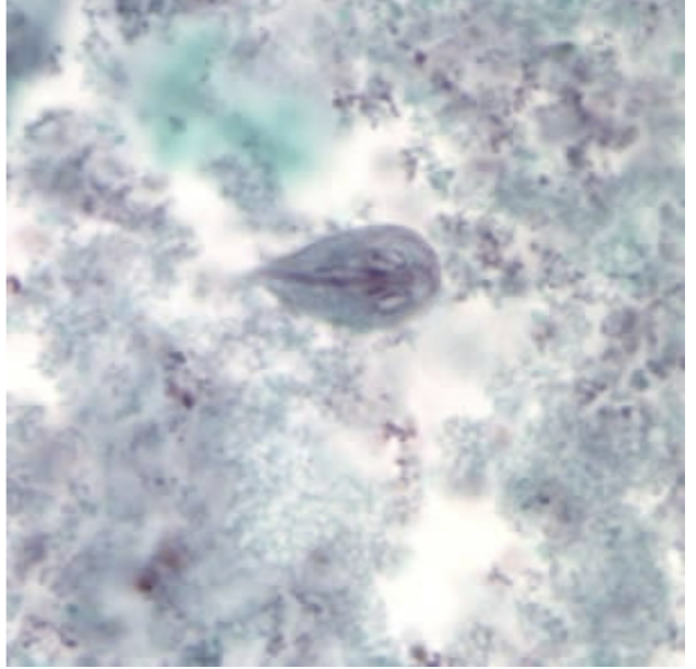 <p>-Pear shaped</p><p>-Central axoneme</p><p>-2 nuclei</p><p>-2 sucking disks</p><p>-2 parabasal</p>