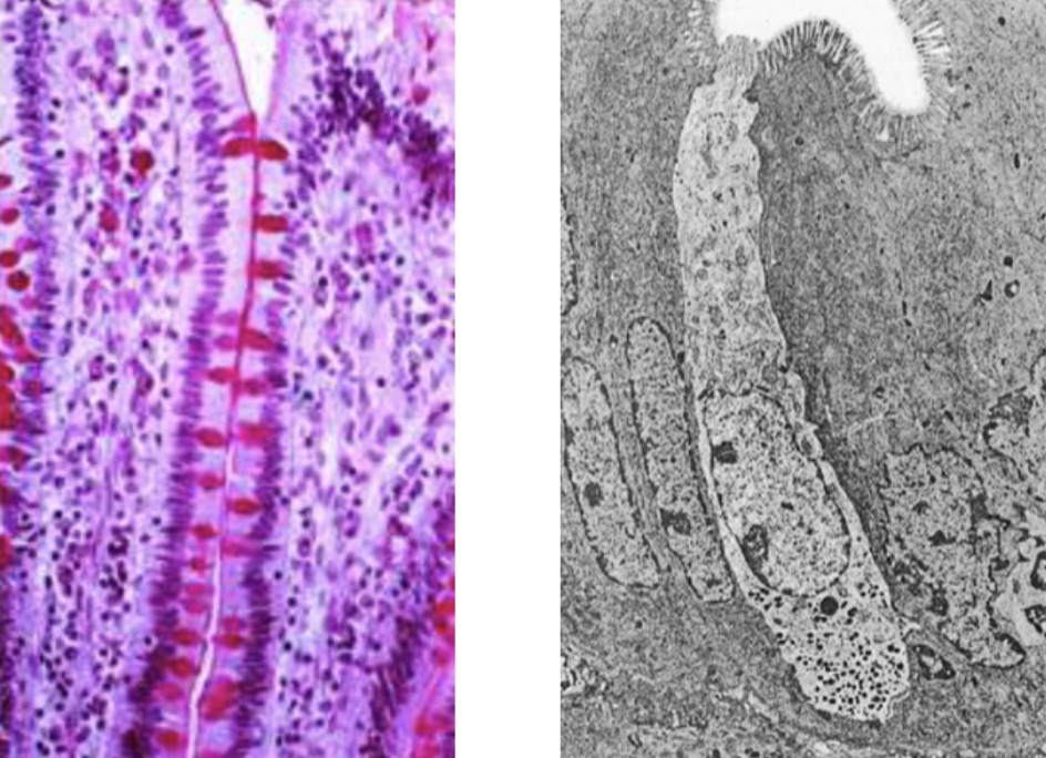 <p>Cells in the lamina epithelialis that produce gut hormones</p>