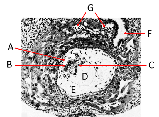<p>Label A, B, C, D, E, F and G</p>
