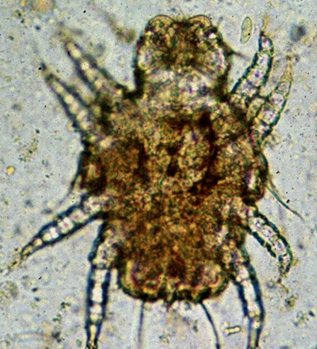 <p>A 10-year-old F/S Scottish terrier presents w/ excessive flaking dermatitis. What are they?</p>