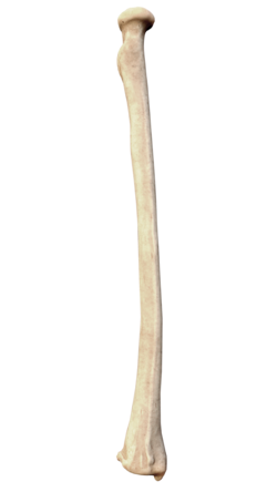 <p>Identify this bone</p>