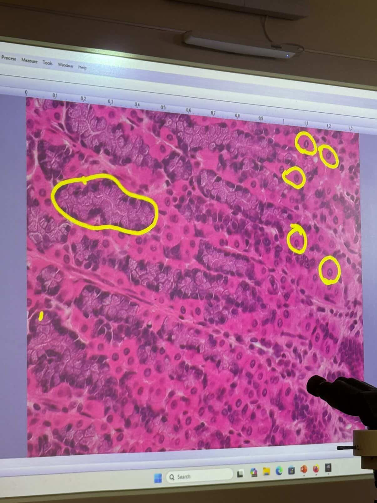 <p>Parietal cells in gastric glands</p>