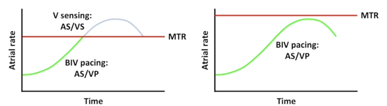 <ul><li><p>Atrial rate faster than MTR:</p><ul><li><p>CHB: pacemaker Wenckebach and fixed ratio block</p></li><li><p>No CHB: intrinsic rate comes through, lower % BIV pacing</p></li></ul></li><li><p>Common to <strong>increase MTR in CRT devices</strong></p></li></ul><p></p>