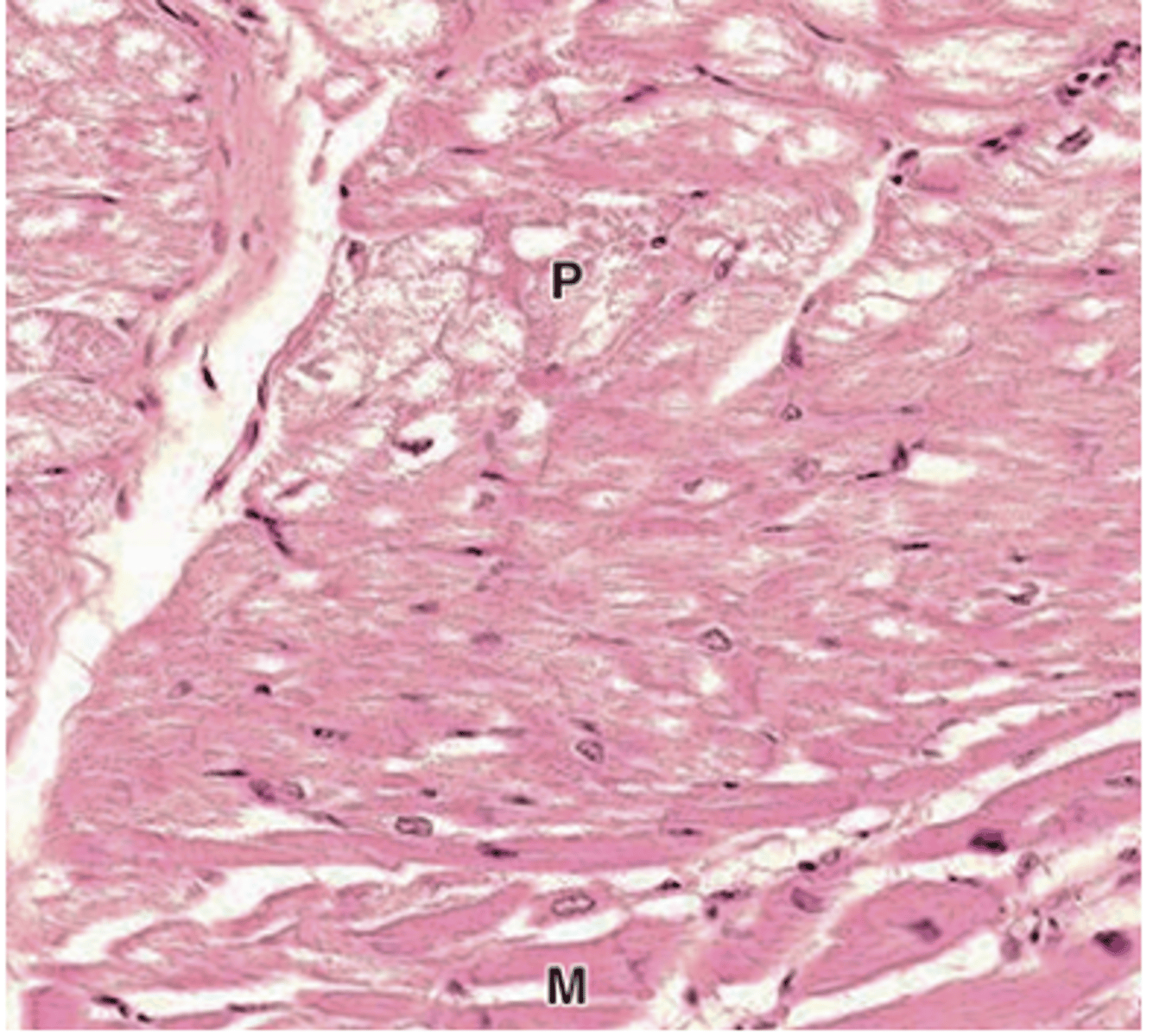 <p>How are Purkinje fibers connected to each other?</p>