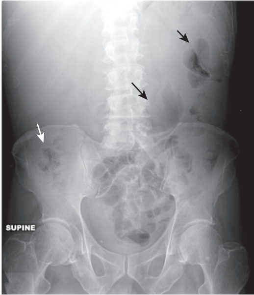<p>diagnosis</p>