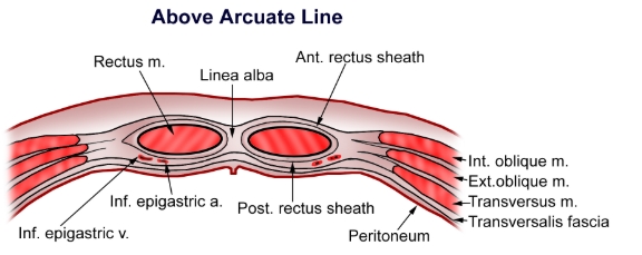 <ul><li><p>Rectus m.</p></li><li><p>Linea alba</p></li><li><p>Ant. rectus sheath</p></li><li><p>Inf. epigastric v.</p></li><li><p>Inf. epigastric a.</p></li><li><p>Post. rectus sheath</p></li><li><p>Peritoneum</p></li><li><p>Int. oblique m.</p></li><li><p>Ext. oblique m.</p></li><li><p>Transversus m.</p></li><li><p>Transversalis fascia</p></li></ul><p></p>