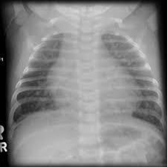 <p>Diagnosis</p>
