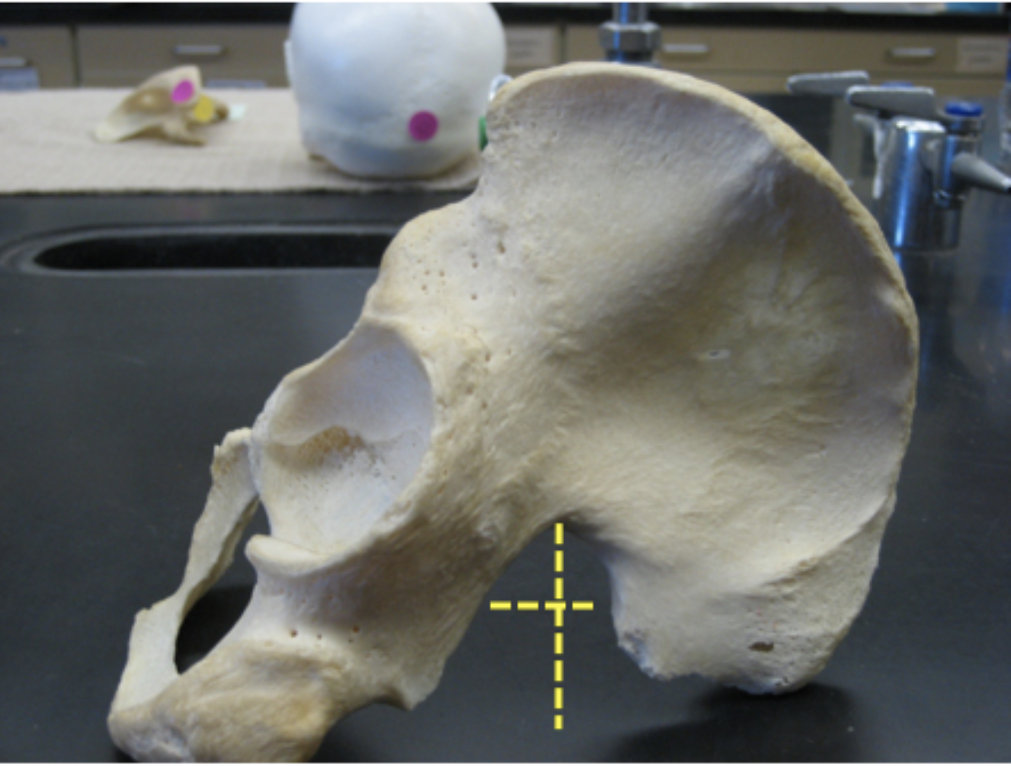 <p>male or female?</p>