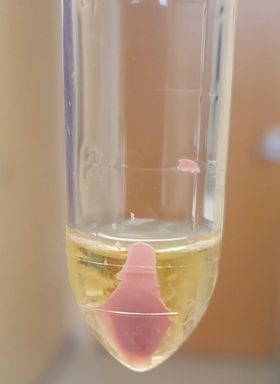 <p>A refrigerated urine specimen appearing to have a pink sediment contains </p>