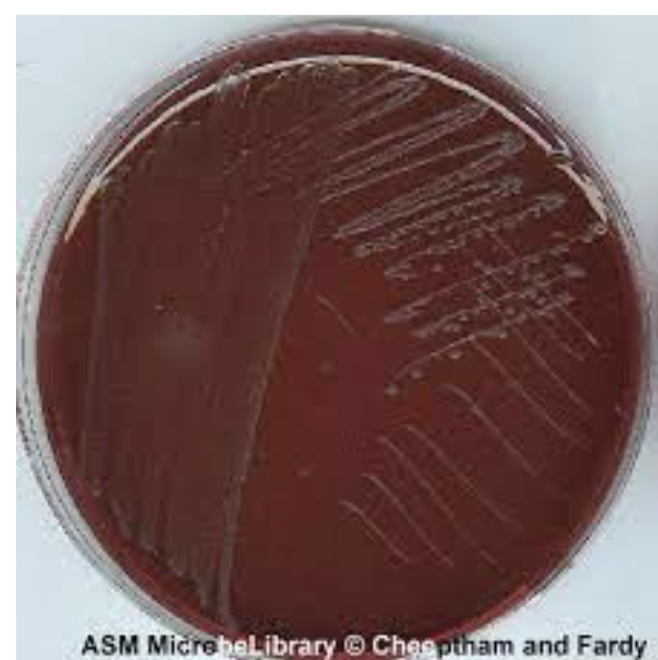 <p>what bacteria is colorless and doesn’t ferment lactose?EMB</p>