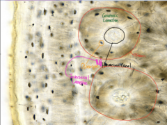 <p>- Osteon</p><p>- Haversian Canal </p><p>- Osteocytes</p><p>- Concentric Lamellae </p><p>- Interstitial Lamellae</p>