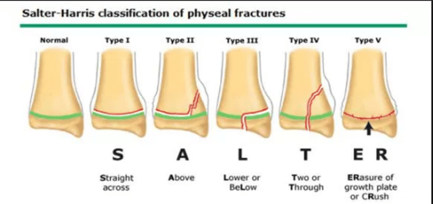 <p>SALTER-HARRIS - Physeal Injuries</p><p>(SMACK - Same, Metaphysis, Articulation, Continuous, Krush) (SALTR - Same, Above, Lower, Through, Really bad)</p><p>1 - fracture through physis</p><p>2 - fracture through physis into metaphysis</p><p>3 - intra-articular fracture through physis into epiphysis</p><p>4 - intra-articular fracture through epiphysis, physis, and metaphysis 5 - crush injury</p>