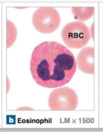 <p>Granular leukocyte that is mainly involved in allergic reaction and parasitic infections</p><ul><li><p>Granules are large and stain red-orange color</p></li><li><p>Nuclei have 2 lobes</p></li><li><p>Capable of phagocytosis</p></li></ul><p></p>