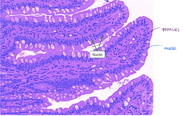 <p>= synthetic molecules with 2 properties : affinity for target &amp; absorbs light</p><p></p><p>ex. Hematoxylin - binds to nucleic acids (DNA/RNA)</p><p>ex. Eosin - binds to proteins</p><p></p><p>→ H&amp;E staining:</p><ul><li><p>by using their natural affinities for staining, it makes nuclei blue &amp; cytoplasm pink (proteins)</p></li></ul><p></p>